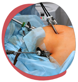 Preparo para cirurgia bariátrica